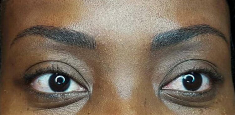 Des sourcils après le microblading