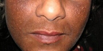 Promotion des produits éclaircissants : Le CSC attaque “Faridah cosmétiques “