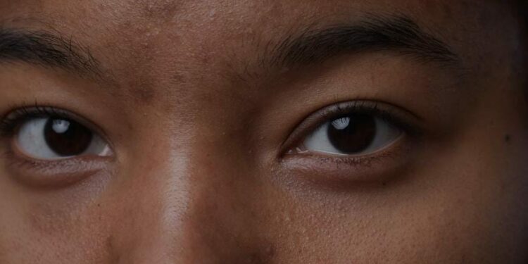 Astuce beauté : Les bienfaits du café pour la peau ayant des boutons ou taches