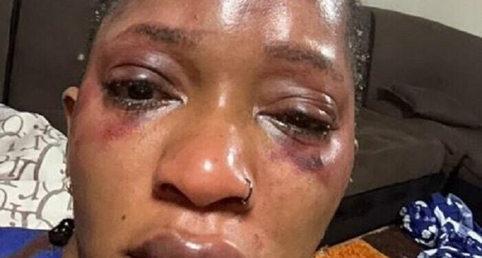 Guinée : L’artiste Djelykaba Bintou accuse son ex-mari de violences conjugales