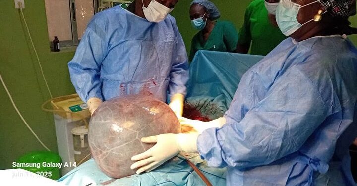 Tenkodogo : Un kyste de 20 kg, opéré avec succès