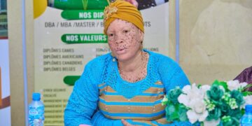 Albiweek 7 : Les personnes atteintes d’albinisme veulent briller sous un nouveau jour