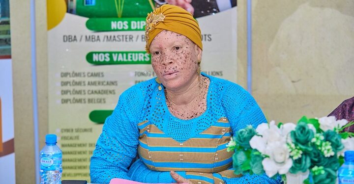 Albiweek 7 : Les personnes atteintes d’albinisme veulent briller sous un nouveau jour