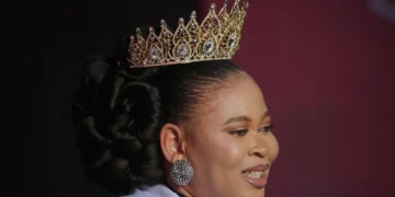 Nigeria : Anita Chidiebube-Dike, la toute première reine de beauté albinos du monde